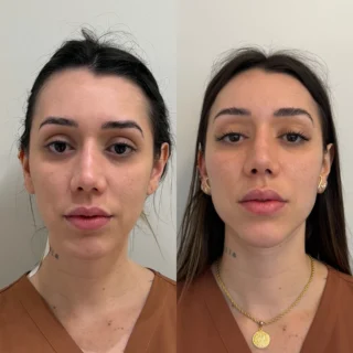 Hoje, o meu orgulho fala mais alto. Este antes e depois…